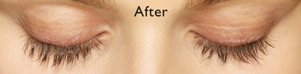 Closed eyes with long eyelashes after Latisse