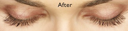 Closed eyes with long eyelashes after Latisse