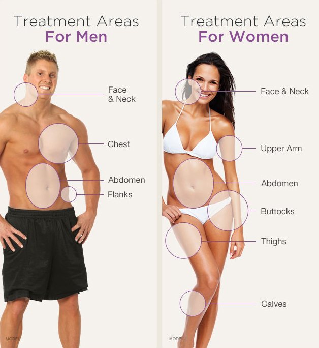 Treatment areas for men are face and neck, chest, abdomen, and flanks. Areas for women are face and neck, upper arm, abdomen, buttocks, thighs, and calves.